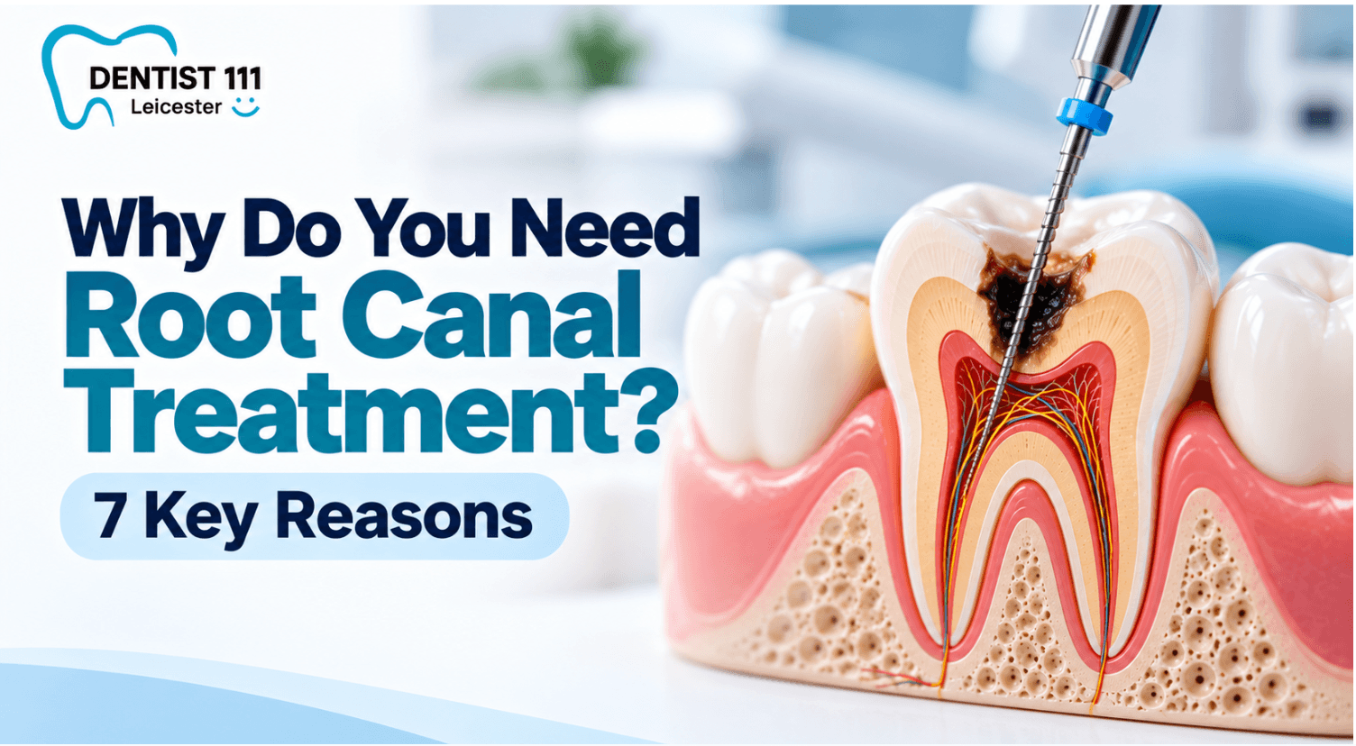 Why Do You Need Root Canal Treatment? 7 Key Reasons Dentist examining a patient's dental X-ray to determine if root canal treatment is required.
